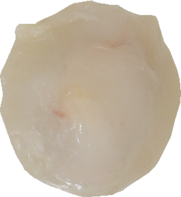 ライチ｜商用可フリー画像・背景透過