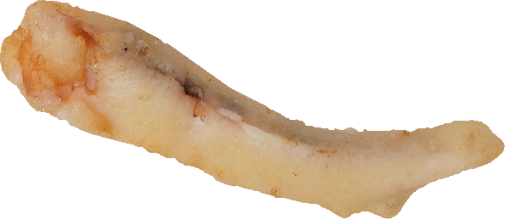 天ぷら（いか）｜商用可フリー画像・背景透過