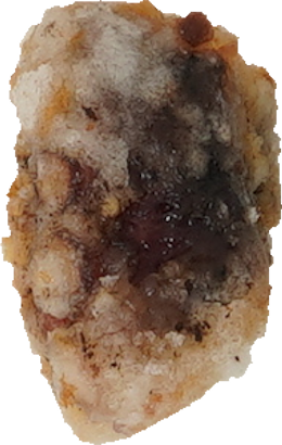 タコの竜田揚げ｜商用可フリー画像・背景透過