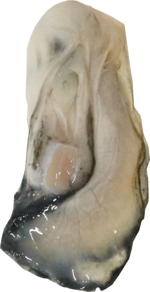 かき｜商用可フリー画像・背景透過